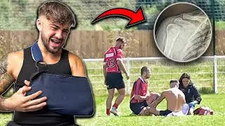I SNAPPED MY SHOULDER IN PRE-SEASON | Game Day Vlog