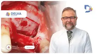 Imersão em levantamento de seio maxilar  - Sinus