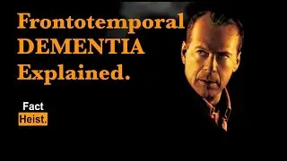 FRONTOTEMPORAL DEMENTIA EXPLAINED .