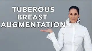 Tuberous Breast Correction - Before & After Of Breast Augmentation Surgery!