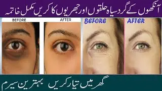 how to remove wrinkles under eyes naturally | how to remove under eye wrinkles under dark circles