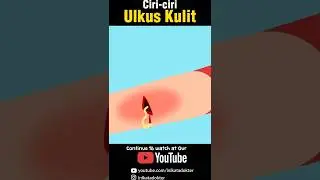 Ciri-Ciri Ulkus Kulit (Luka Borok)
