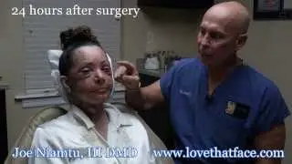 The Truth about Facelift Recovery with Multiple Procedures: by Dr. Joe Niamtu, III