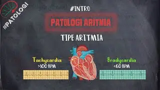 Patologi Aritmia | Tipe Aritmia