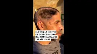 IL PERD LA MOITIÉ DE SON CERVEAU DANS UNE ATTAQUE ISRAÉLIENNE