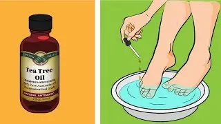 Tea tree oil is far more useful than you think - 7 reasons to have tea tree oil in your house