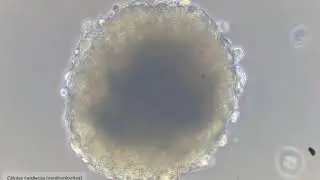 Bioinformática: 2. Organización del material genético.