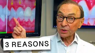 3 Reasons Your Gums Are Inflamed and How to Treat at Home 🦷🔥