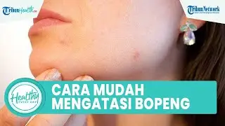 Bopeng di Wajah akibat Jerawat Bisa Diatasi dengan Bahan Alami hanya di Rumah: Lidah Buaya dan Madu