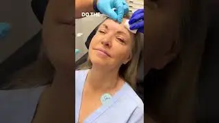 Lines & Wrinkles: My Botox Journey #Botox