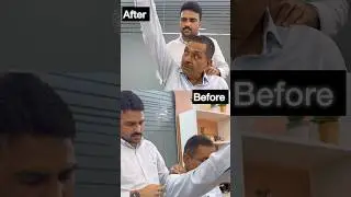 Frozen shoulder chiropractic magical treatment by dr harish grover #trending #feed #ytshortsfeed