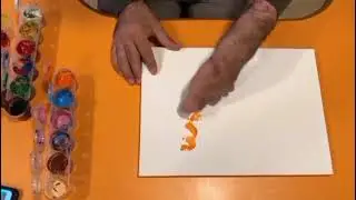 İş kazası, el yaralanması