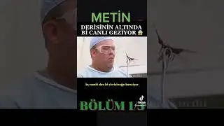 Adamın derisinin altında bir canlı geziyor