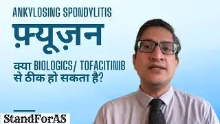 Ankylosing spondylitis: फ़्यूज़न क्या biologics/ tofacitinib से ठीक हो सकता है?