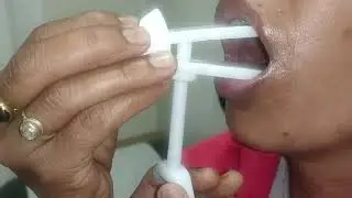 Grading of Trismus by TrisCaRe in Hindi.  Dr. Pawan Gupta.  ICanCaRe