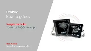 How to save as DICOM and jpeg on the ExaPad