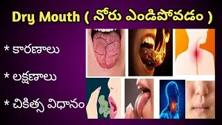 Dry Mouth Causes, Symptoms and treatment in Telugu