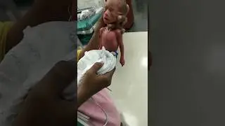 Doctor Saved Baby life ❤.         