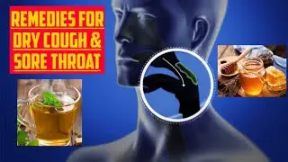 Top 10 Effective Remedies For Sore Throat and Dry Cough | Sore Throat Fast Relief