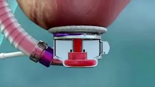 HeartMate 3 Animation