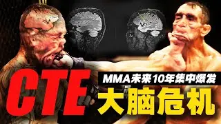 CTE来袭：MMA界未来10-15年将集中爆发的无解性大脑危机