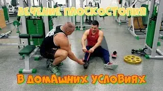 Как вылечить плоскостопие в домашних условиях