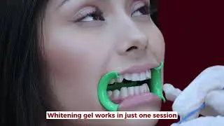 How do we do our teeth whitening?