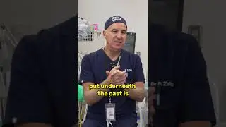 Why Getting Your Cast Wet Is a BIG No-No!