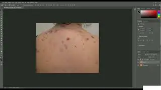 PHOTOSHOP  Retouching, PART 30  Skin Retouch   Remove Bad Spot From Skin