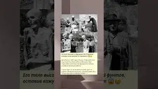 Его тело высохло и сморщилось до 33 фунтов, оставив кожу похожей на пергамент 😱😢