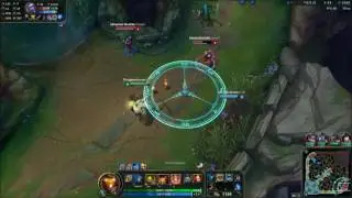 Bard sucks