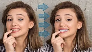 Photoshop Tutorial The Best Way to Whiten Teeth