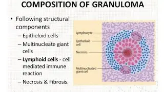 Explanation of Granuloma ; Definition, Composition, Characteristics and Why it is formed
