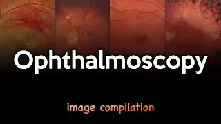 Ophthalmoscopy