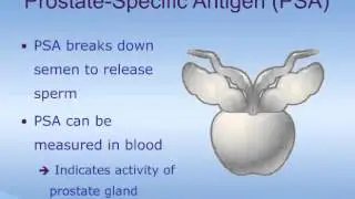Understanding the Prostate and Prostate Conditions