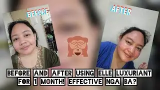 THE BEFORE AND AFTER RESULT OF USING ELLE LUXURIANT | EFFECTIVE NGA BA O HINDI? | SEE THE RESULTS.