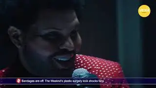 The Weeknd’s plastic surgery look shocks fans