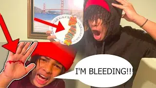 100 LAYERS of SOUR PATCH KIDS CHALLENGE (I Cut My Hand Open) **100 Subscriber Special**