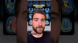THE DIFFERENT TYPES OF BRAIN SCANS pt 2
