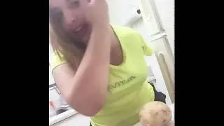 Amputee Woman RSD Paola Andrea Gutierrez Cardenas - Como pelo una papa o patata 🥔