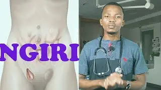 NGIRI|HERNIA: Sababu, Dalili, Matibabu