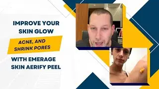 IMPROVE YOUR SKIN GLOW, ACNE, AND SHRINK PORES WITH EMERAGE SKIN AERIFY PEEL | DR JASON EMER