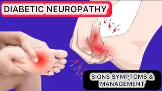 Diabetic Neuropathy: Sign & Symptoms,Types, Causes,Diagnosing and Management