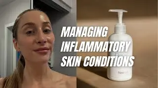 How I Manage My Acne/PD/Rosacea Prone Skin. (PM Routine)