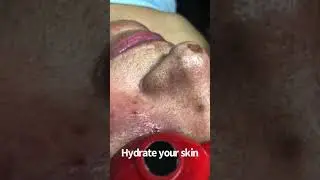 Facial limpieza profunda