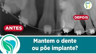 RTG ainda é viável nos dias de atuais?