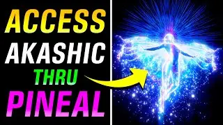AKASHIC Records PORTAL Will Be OPENED into Your PINEAL Gland (MUST TRY)