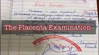 Placenta Examination || Placenta Examination complete Procedure