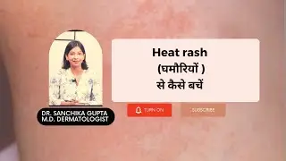 Heat Rash घमौरियों से कैसे बचें / Dr. Sanchika Gupta 👩‍⚕️ #dermatologistinfaridabad #heatrash