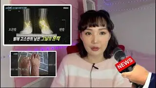Хөлийг нь андуурч мэс засал хийсэн 😳😳😳
